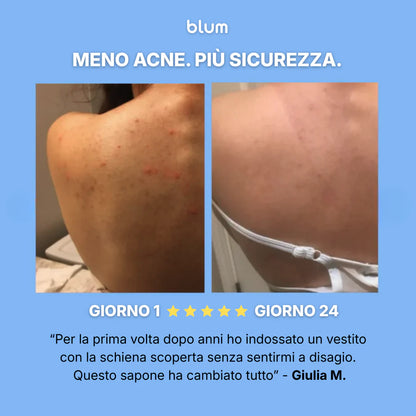 Sapone Purificante Anti-Acne™